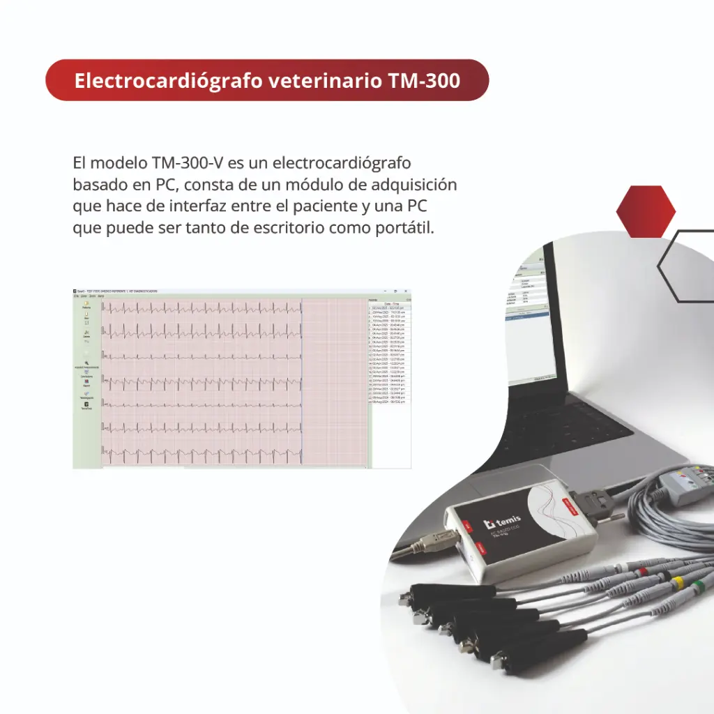 Placa 1 ECG TM300.webp