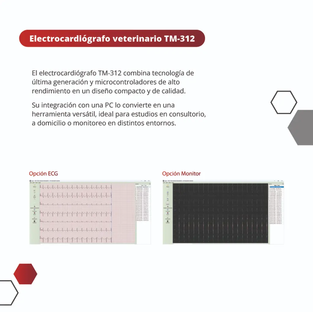 Placa 1 ECG TM312.webp